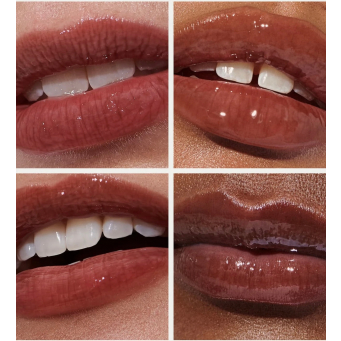 Kujdesi p&euml;r buz&euml;t